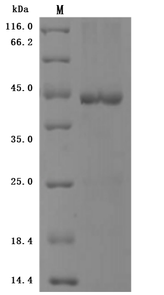 SDS-PAGE