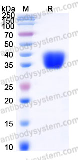 EHE79101, SDS-PAGE