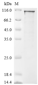 SDS-PAGE