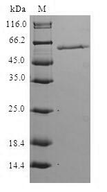 SDS-PAGE