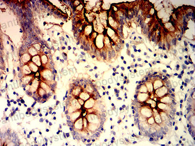 Валидация AntibodySystem RHE25603 (2050)