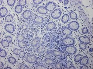 Валидация AssayVector ARM1408(1166)