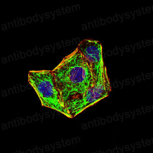 Валидация IF - AntibodySystem RHC95209