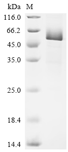 SDS-PAGE