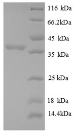 SDS-PAGE