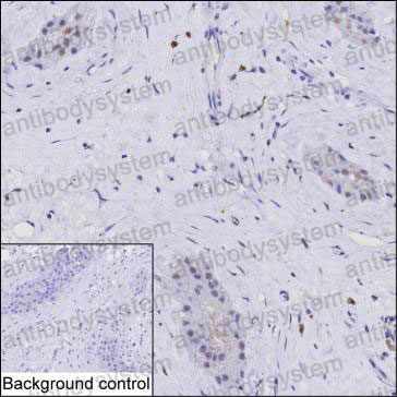 Валидация AntibodySystem RHK62401