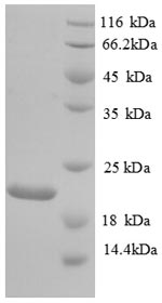 SDS-PAGE