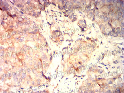 Валидация AntibodySystem RHK27202 (3640)