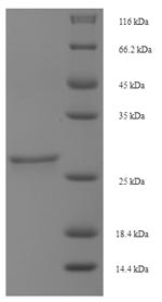 SDS-PAGE