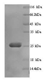 SDS-PAGE