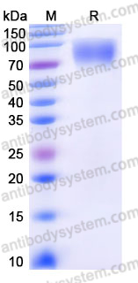 AHH18902, SDS-PAGE
