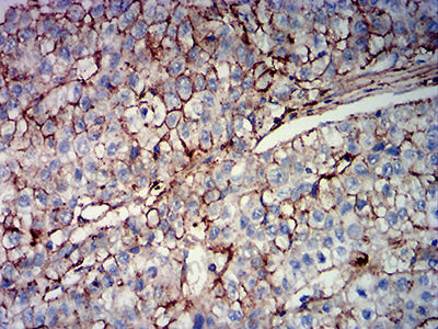 Валидация AntibodySystem RHJ31004 (3367)