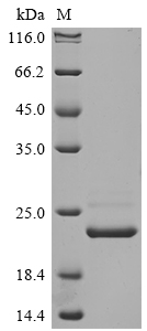 SDS-PAGE