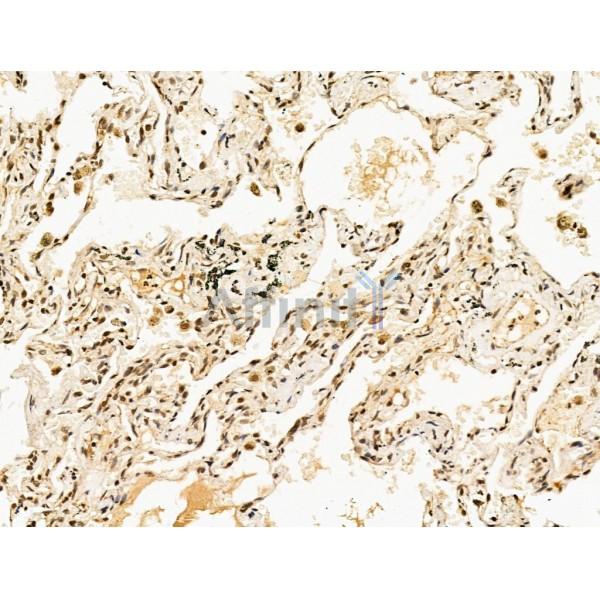 Валидация Affinity DF13635 - 9177