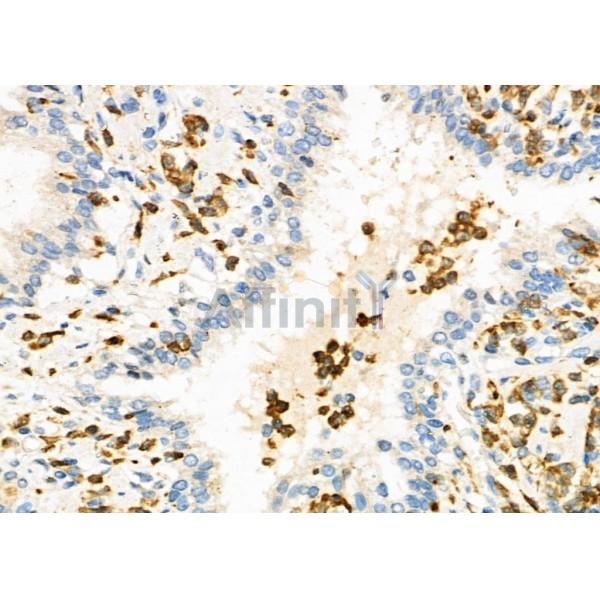 Валидация Affinity DF6531 - 17954