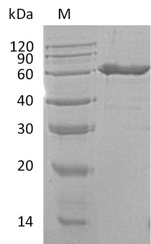 SDS-PAGE