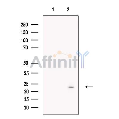 Валидация Affinity DF13534 - 8953