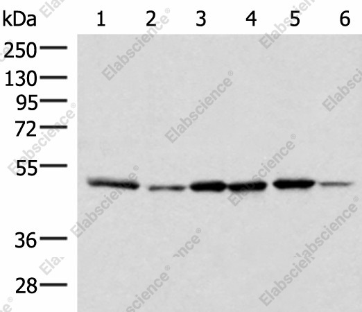 Вестерн-блоттинг, IP6K1, клеточные линии Jurkat, PC-3, HepG2, HeLa, HT-29 и Raji