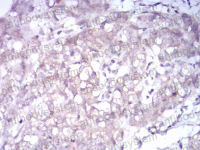 Валидация AntibodySystem RHH31807