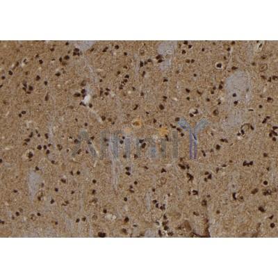 Валидация Affinity DF12187 - 6419