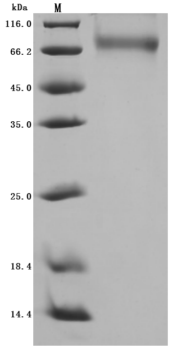 SDS-PAGE