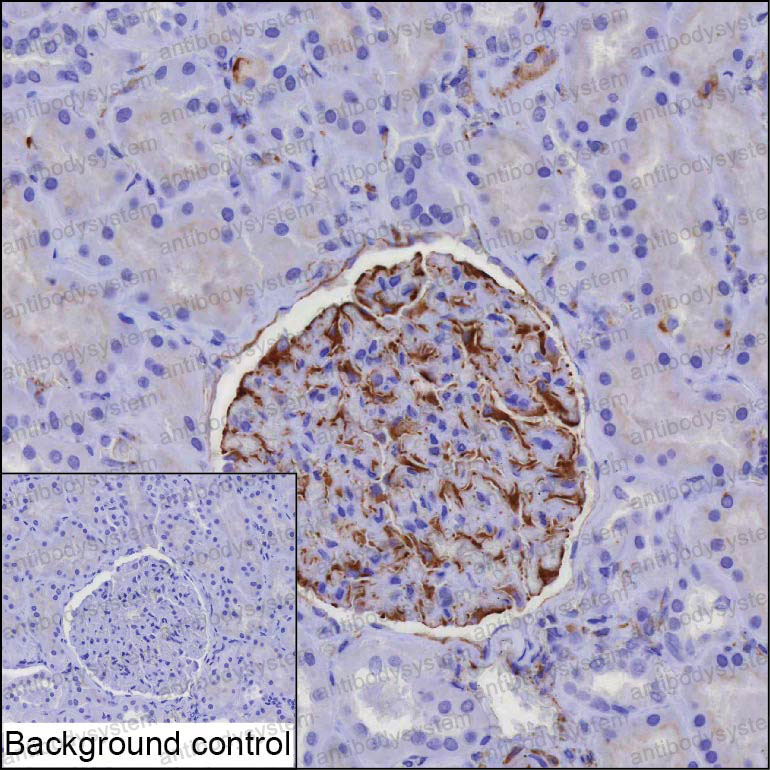 Валидация AntibodySystem RHC12002