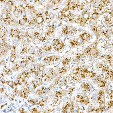 Иммуногистохимия, Cathepsin D, ткань печени человека