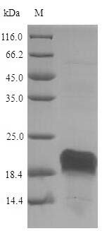 SDS-PAGE
