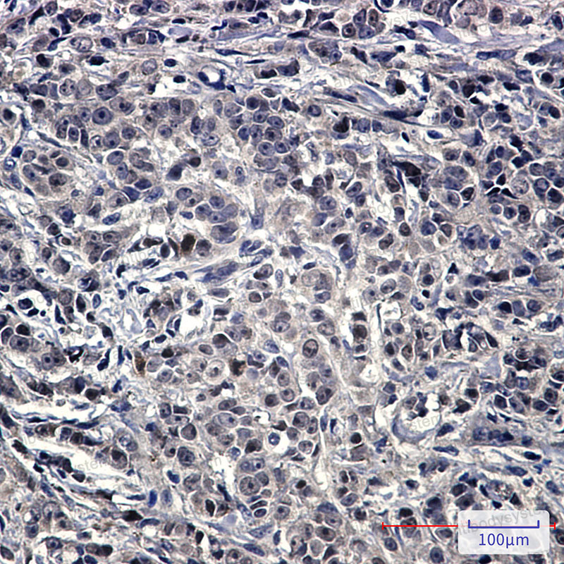 Валидация AntibodySystem RHG93701