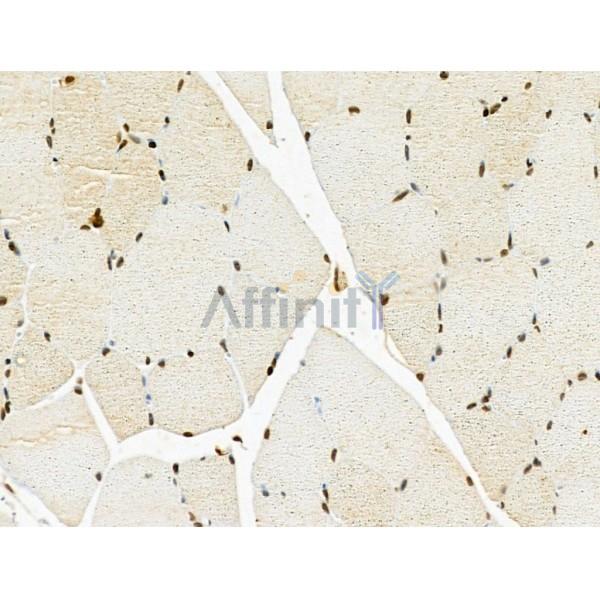 Валидация Affinity DF13064 - 7925