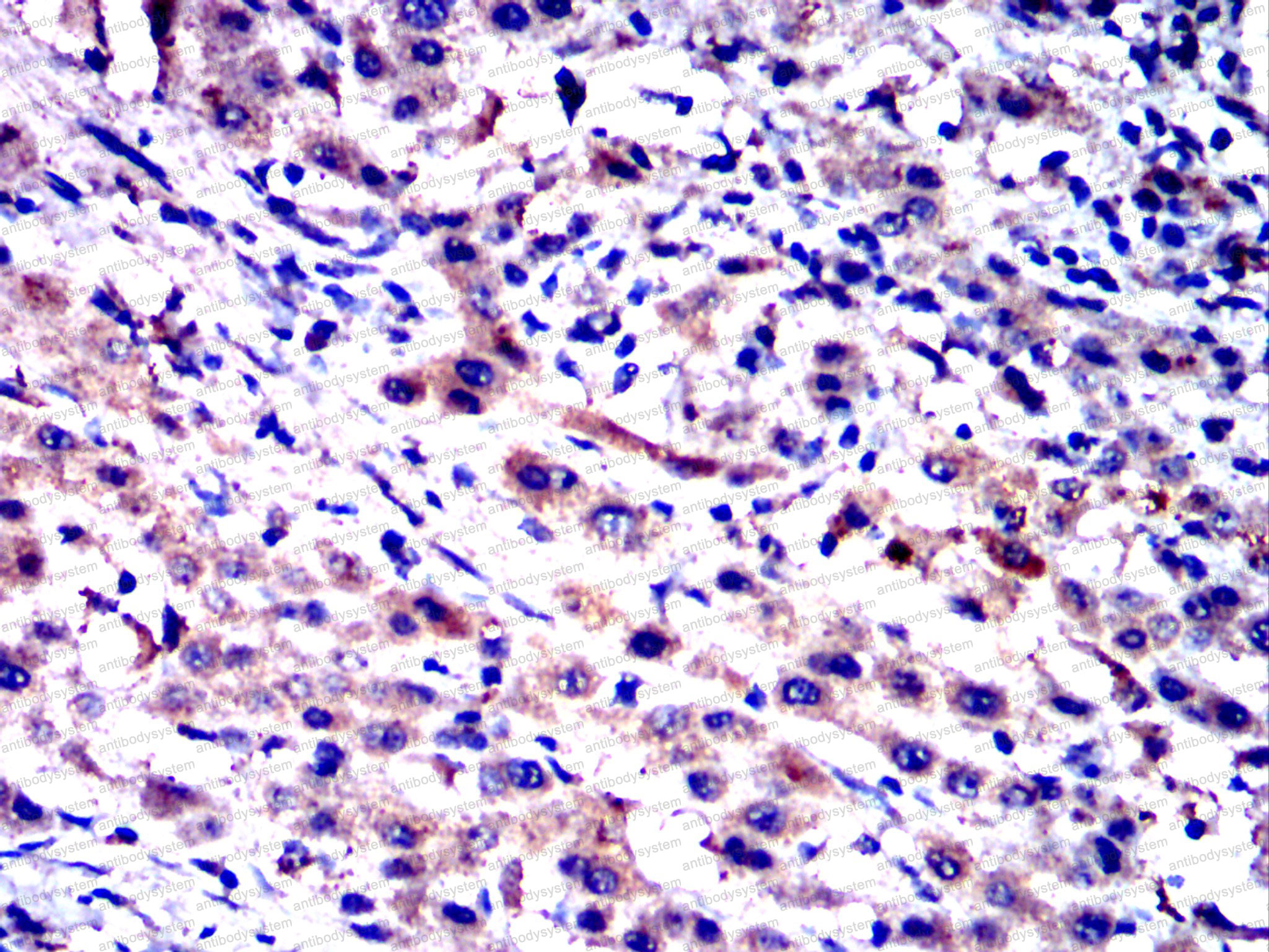 Валидация AntibodySystem RHC15806 (681)