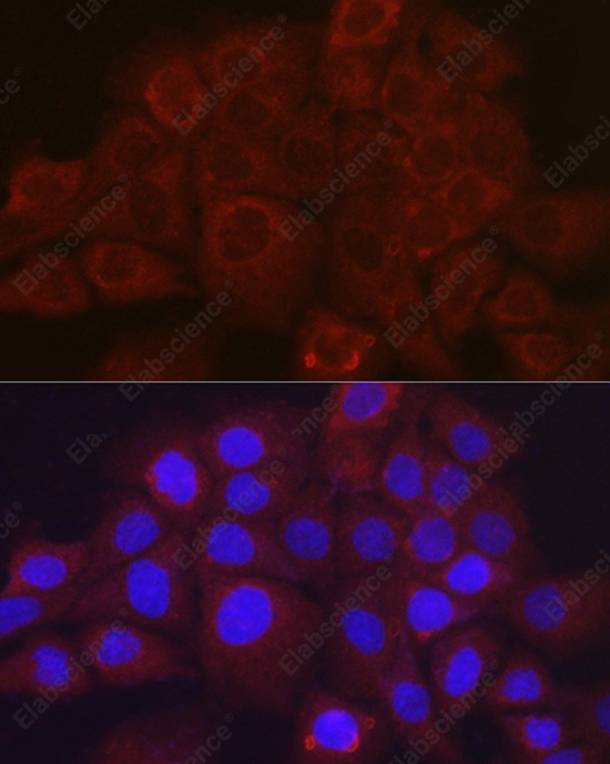 Иммунофлуоресценция, SSCA1/SerpinB3, клетки A431