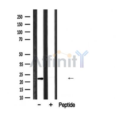 Валидация Affinity DF6919 - 18520