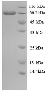 SDS-PAGE
