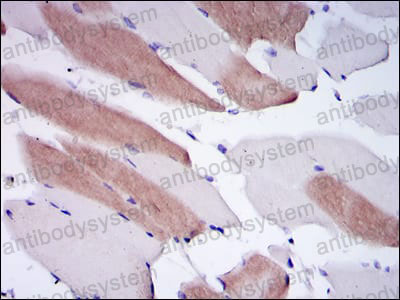 Валидация AntibodySystem RHB98203