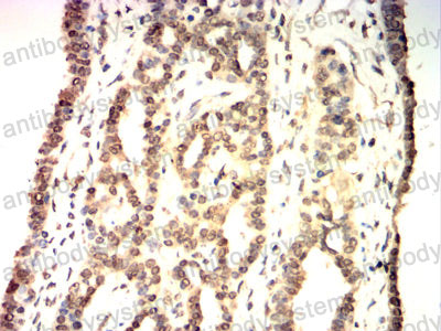 Валидация AntibodySystem RHD31502 (1471)