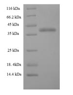 SDS-PAGE