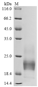 SDS-PAGE