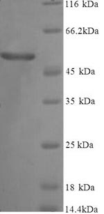 SDS-PAGE