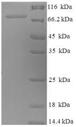 SDS-PAGE