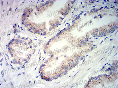 Валидация AntibodySystem RHC27103 (840)