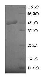 SDS-PAGE