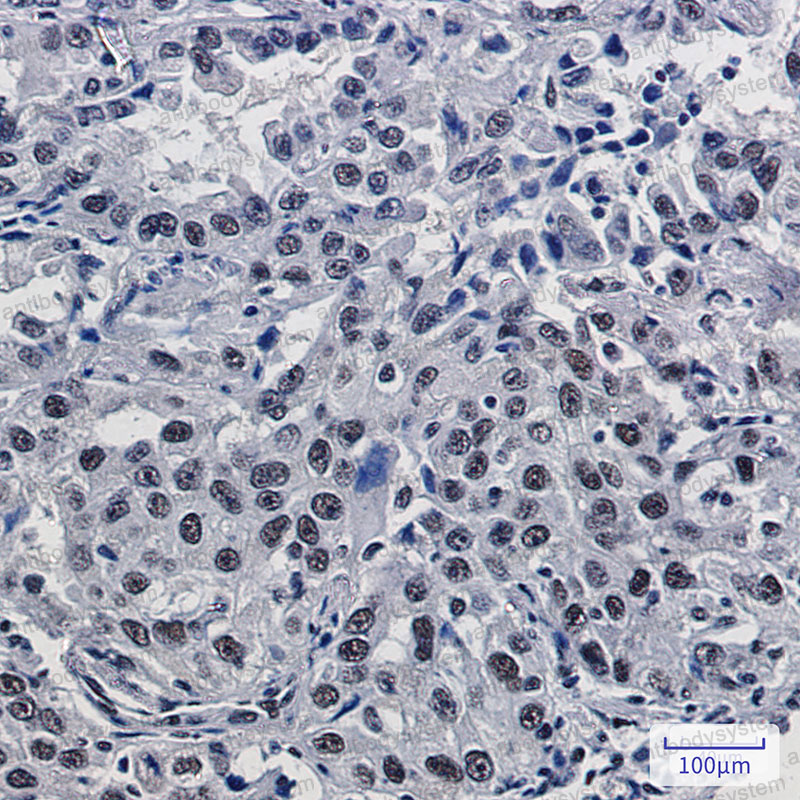 Валидация AntibodySystem RHE73901