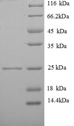 SDS-PAGE