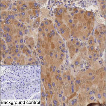 Валидация AntibodySystem RHK05902