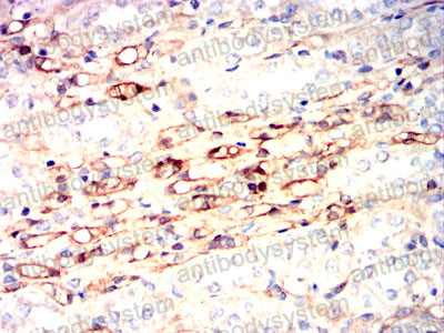 Валидация AntibodySystem RHB26401