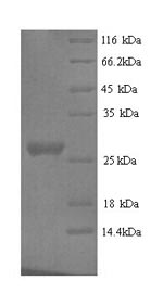 SDS-PAGE