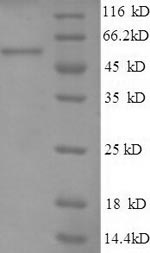 SDS-PAGE