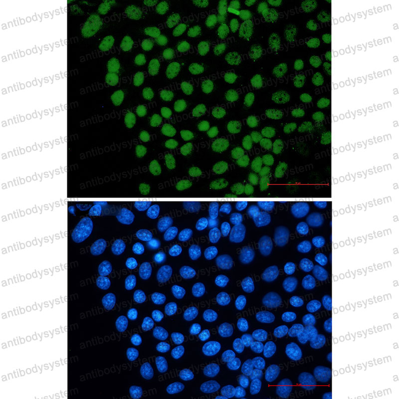 Валидация IF - AntibodySystem RHK31003