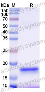 Валидация SDS-PAGE - AntibodySystem RHB95902